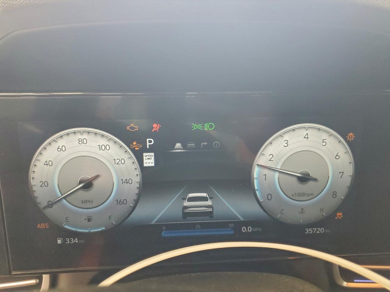2024 HYUNDAI ELANTRA SEL photo 9