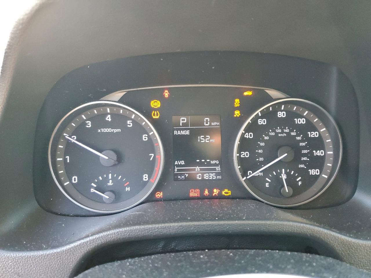 2017 HYUNDAI ELANTRA SE photo 17