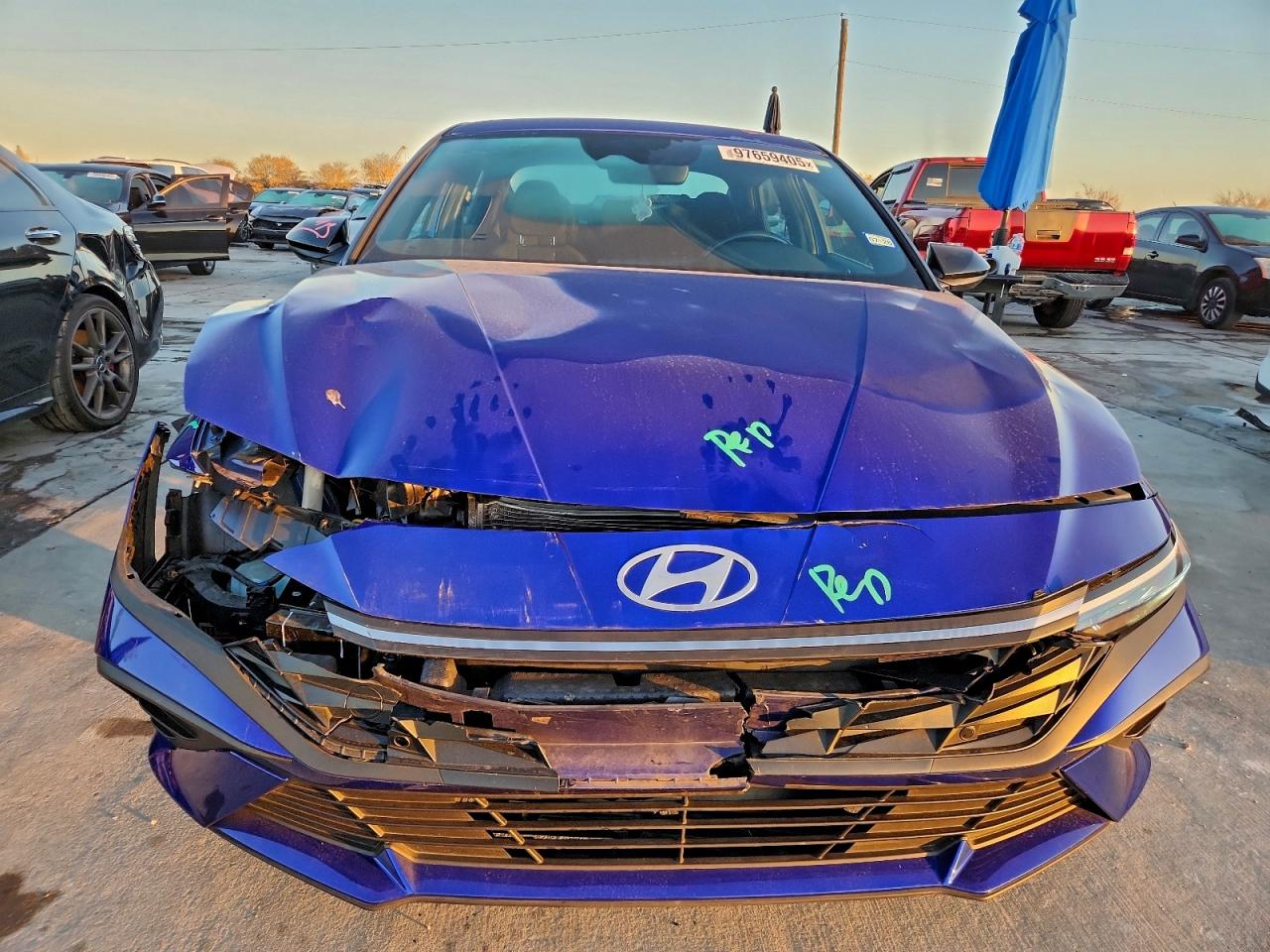2025 HYUNDAI ELANTRA SEL SPORT photo 5