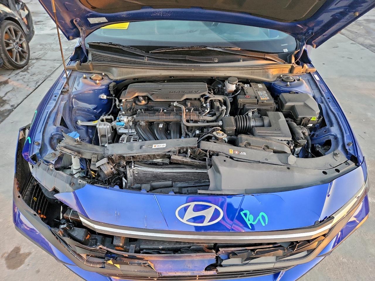 2025 HYUNDAI ELANTRA SEL SPORT photo 11
