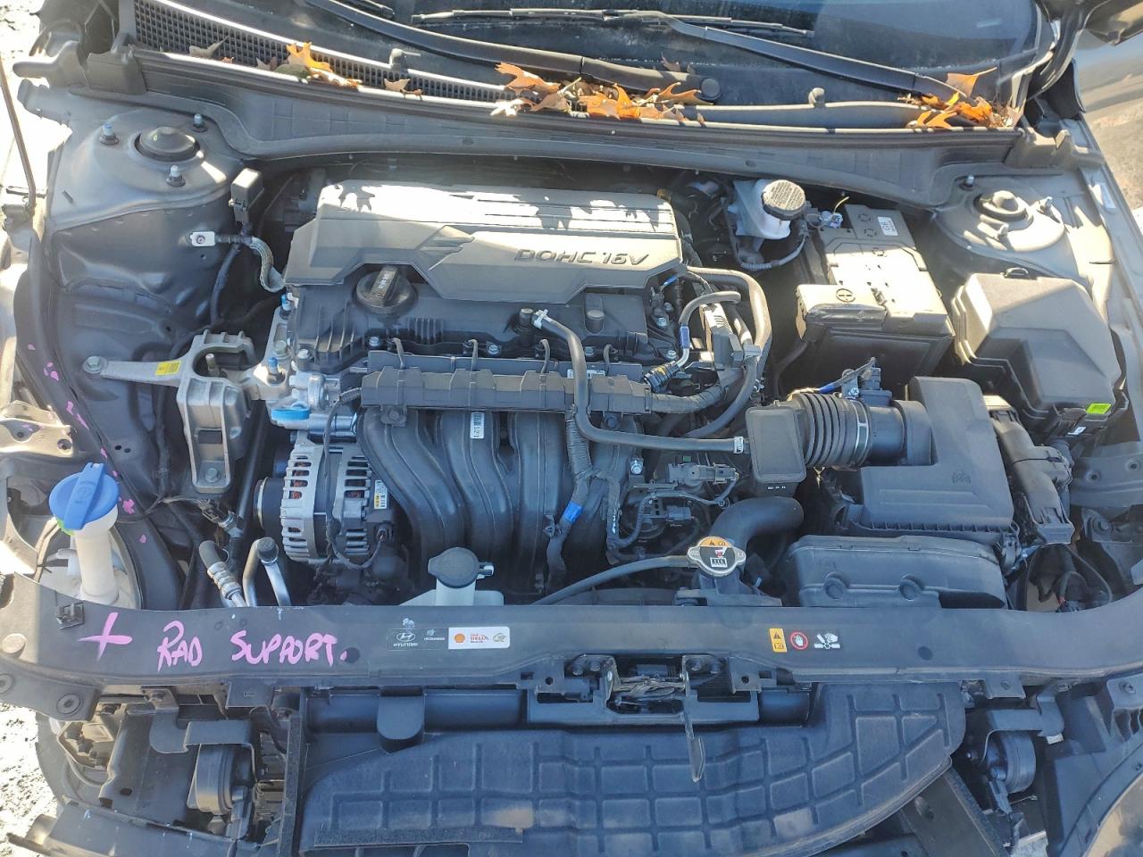 2025 HYUNDAI ELANTRA LIMITED photo 11