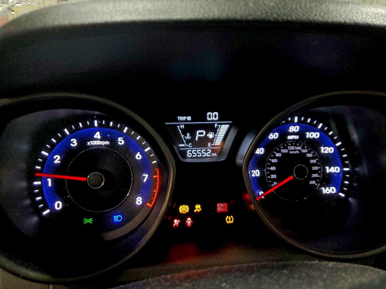 2016 HYUNDAI ELANTRA SE photo 17
