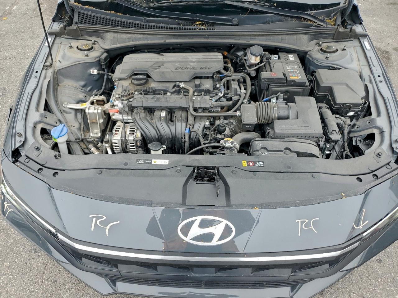 2024 HYUNDAI ELANTRA SEL photo 11