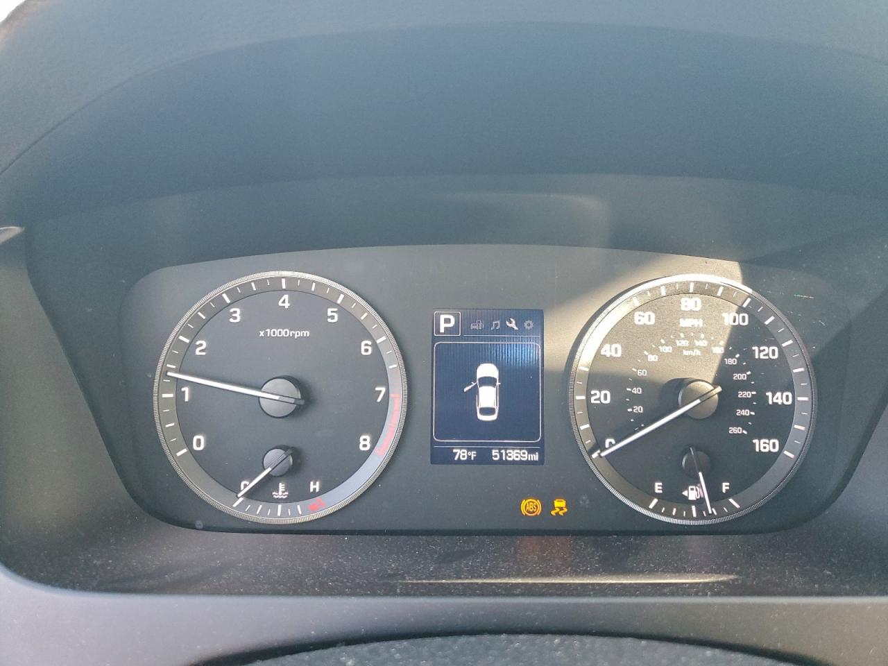 2017 HYUNDAI SONATA SE photo 9
