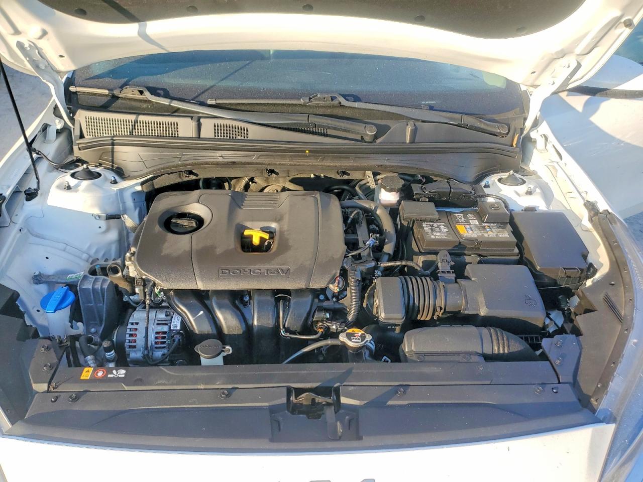 2024 KIA FORTE LXS photo 11