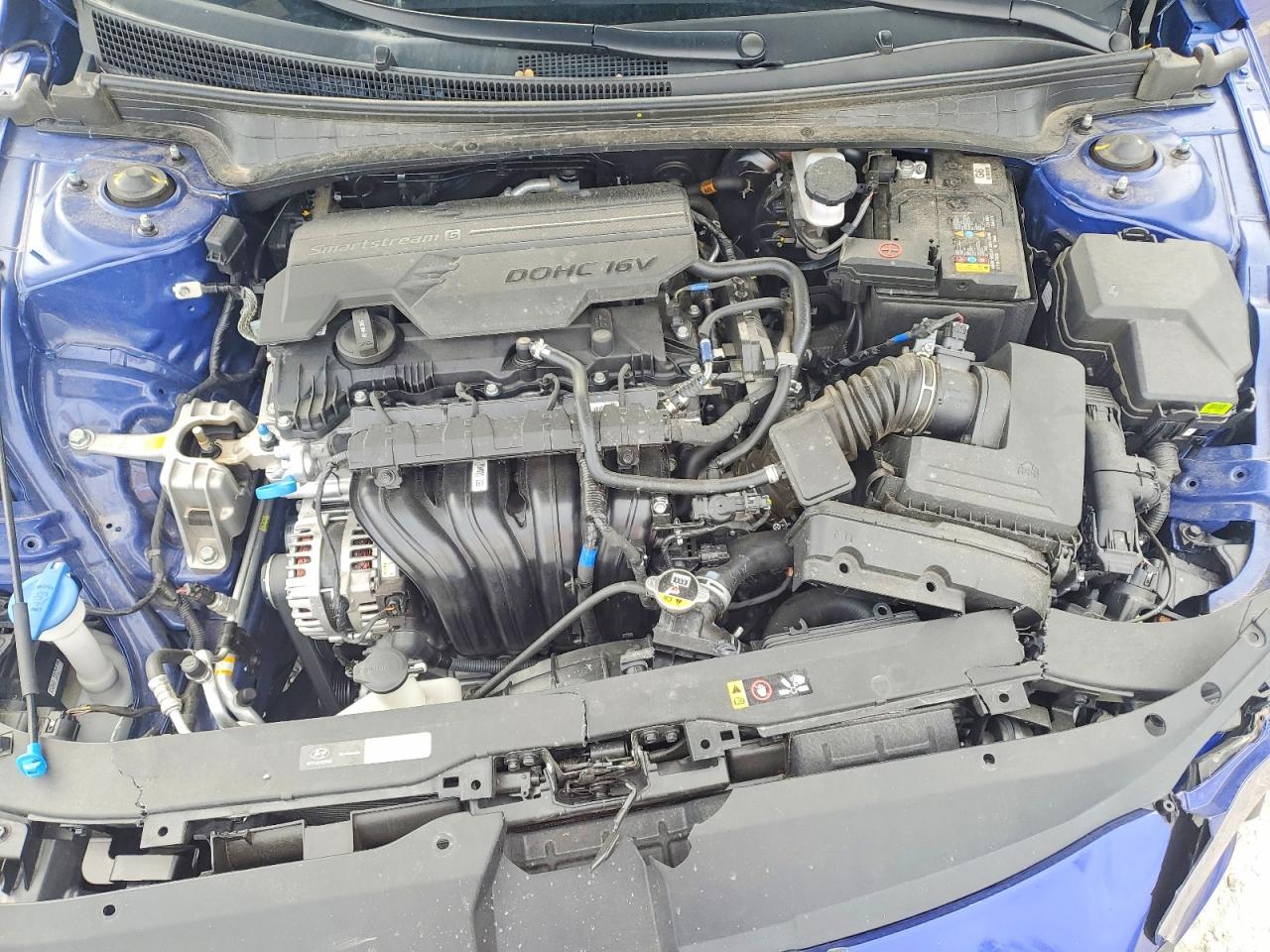 2025 HYUNDAI ELANTRA SEL SPORT photo 11