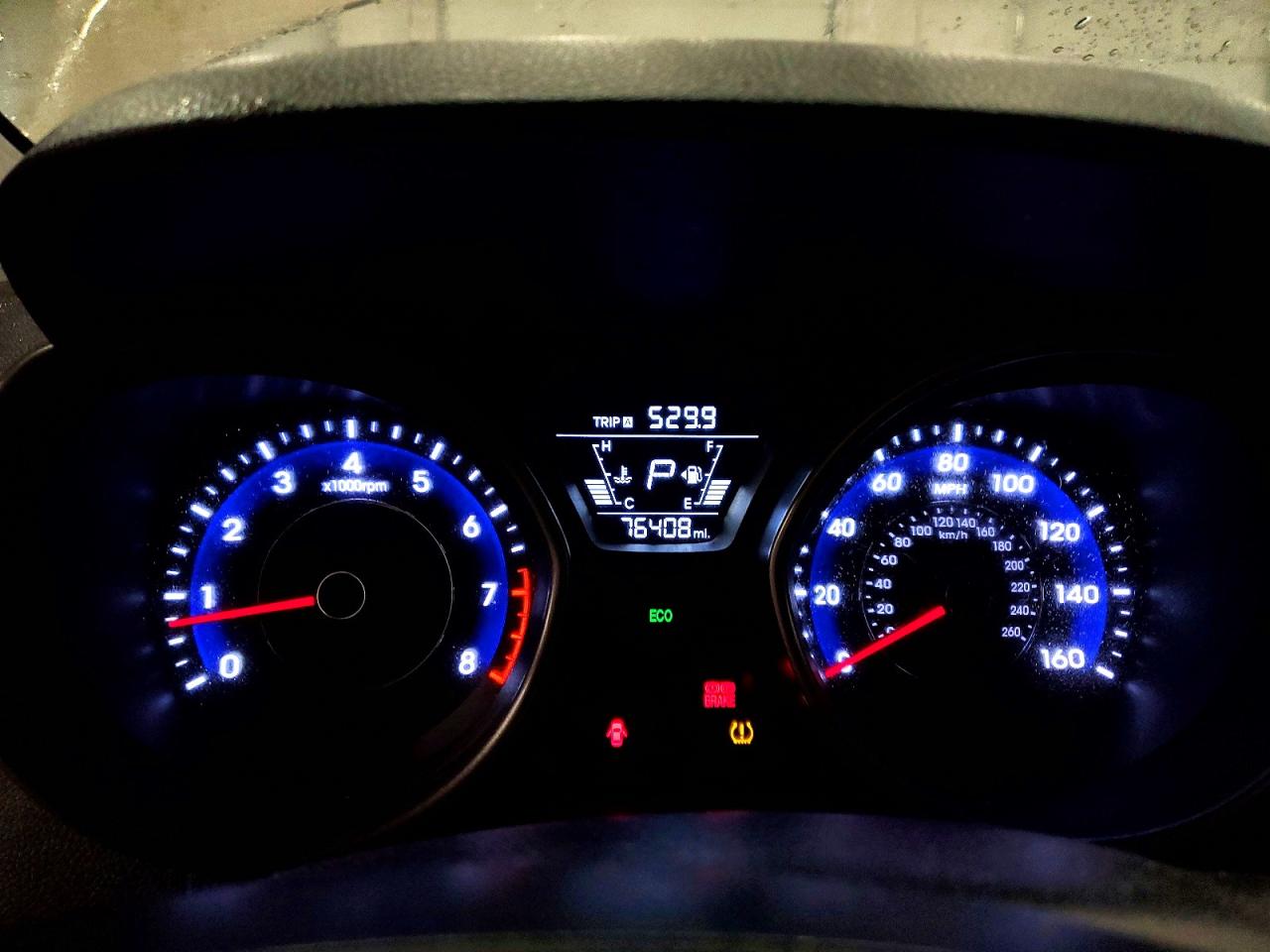 2016 HYUNDAI ELANTRA SE photo 9