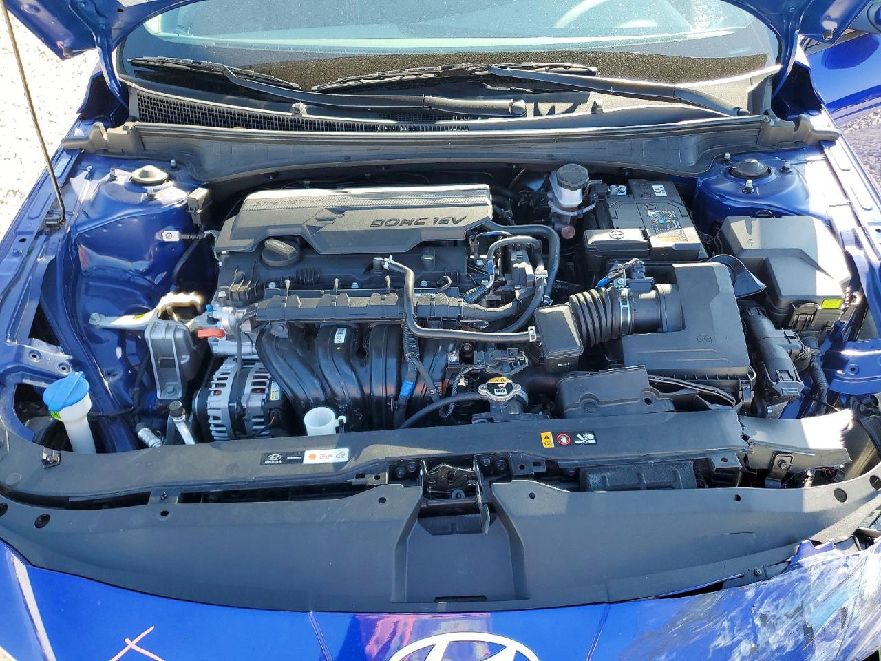 2024 HYUNDAI ELANTRA SEL photo 11
