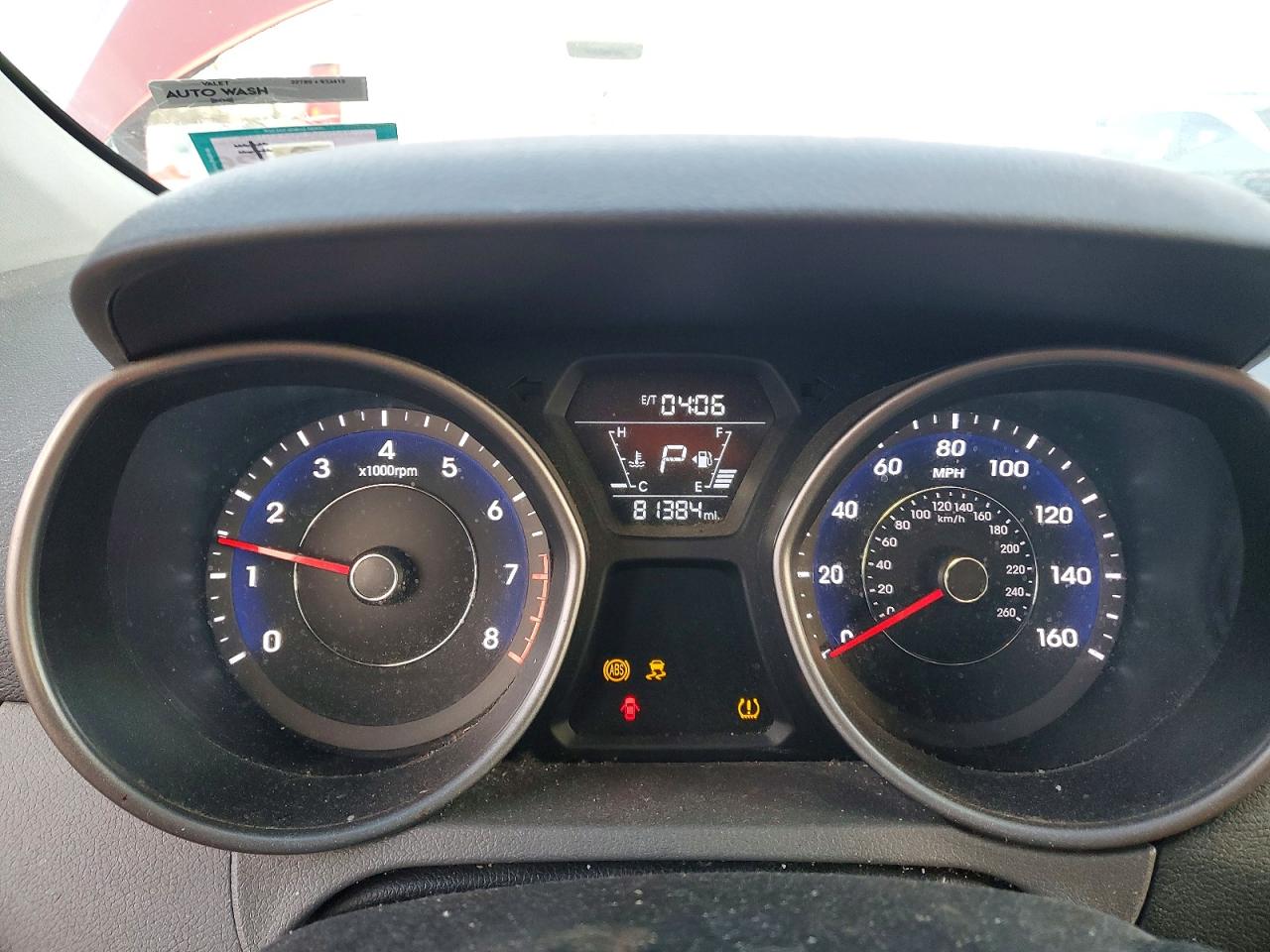 2016 HYUNDAI ELANTRA SE photo 9