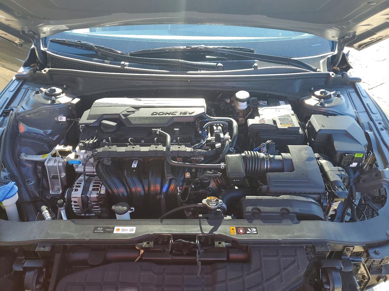 2025 HYUNDAI ELANTRA SEL SPORT photo 11