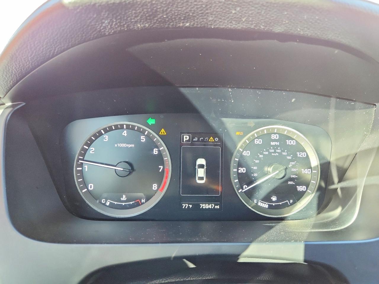 2017 HYUNDAI SONATA SPORT photo 9