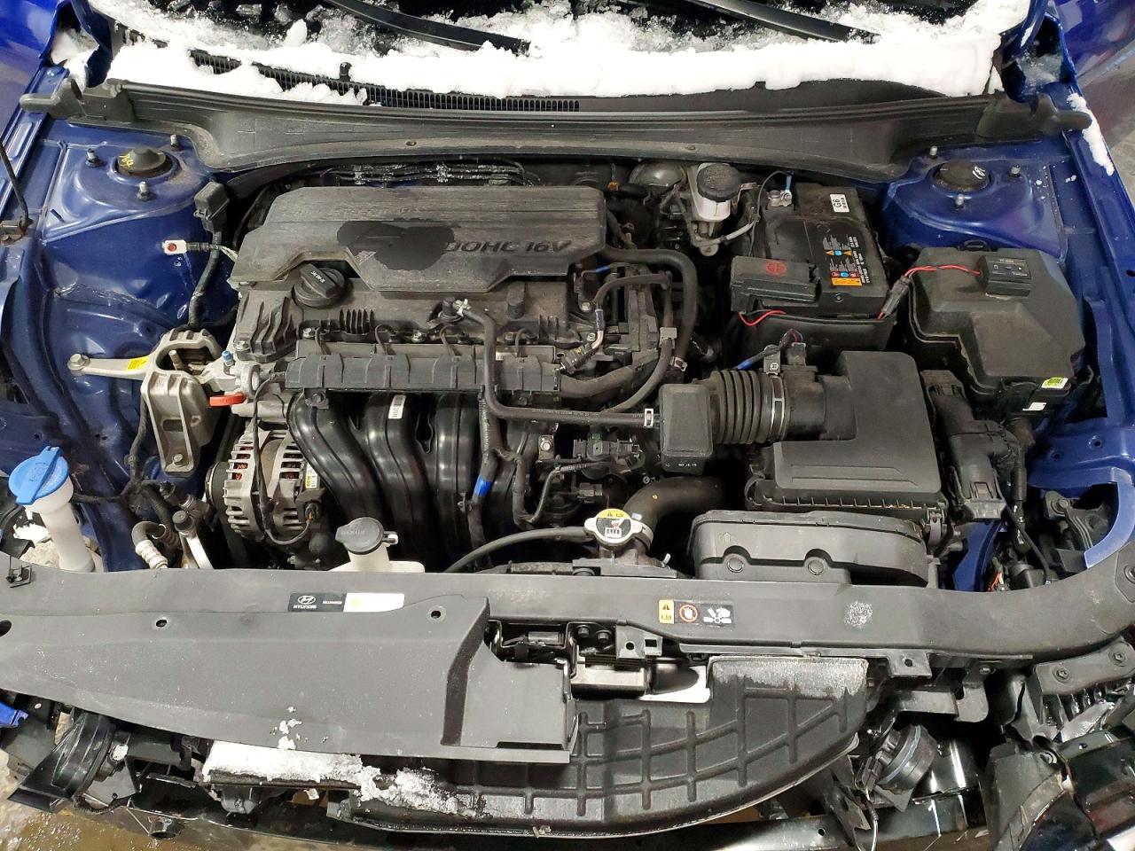 2024 HYUNDAI ELANTRA SEL photo 11