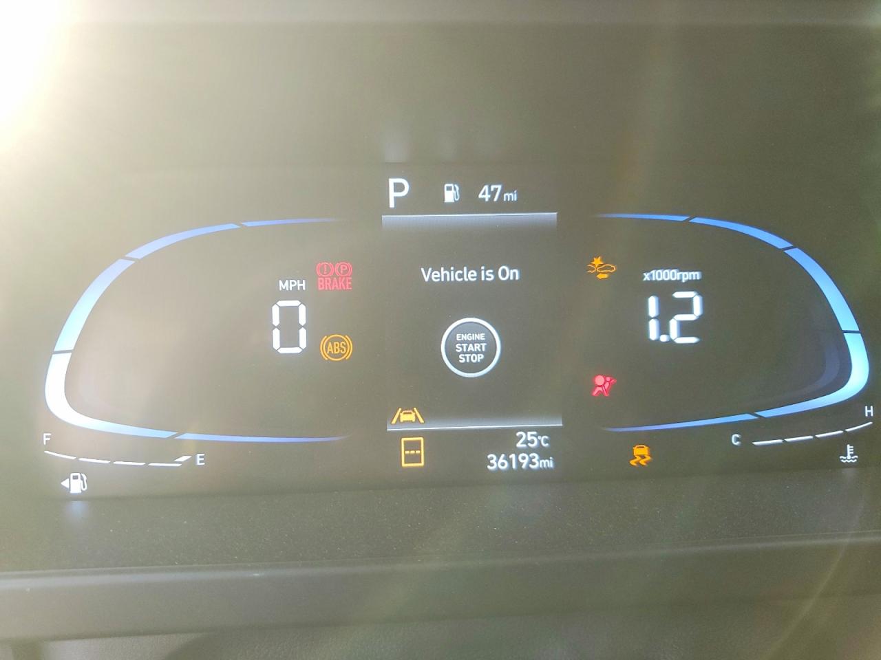2025 HYUNDAI ELANTRA SEL SPORT photo 17