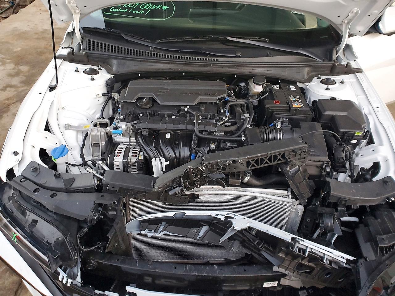 2025 HYUNDAI ELANTRA SEL photo 11