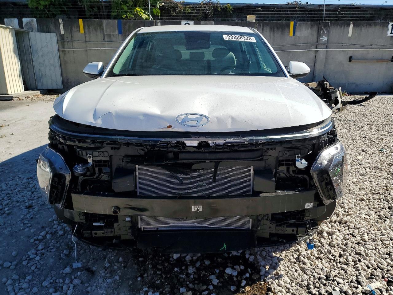 2025 HYUNDAI KONA SE photo 5