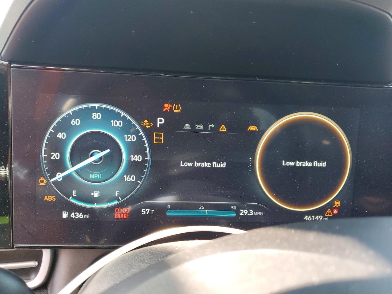 2024 HYUNDAI ELANTRA SEL photo 9