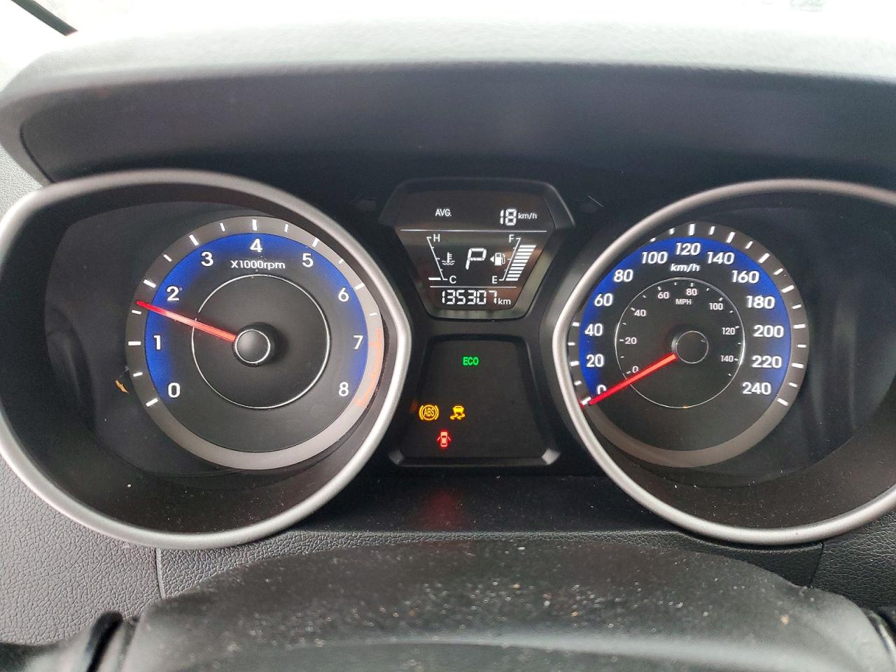 2016 HYUNDAI ELANTRA SE photo 9