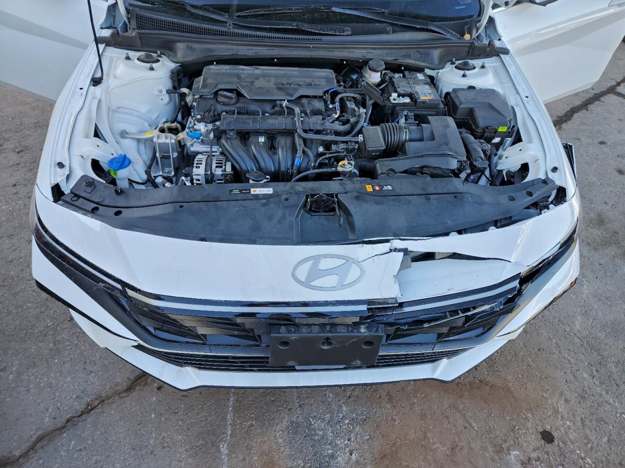 2025 HYUNDAI ELANTRA SEL photo 11