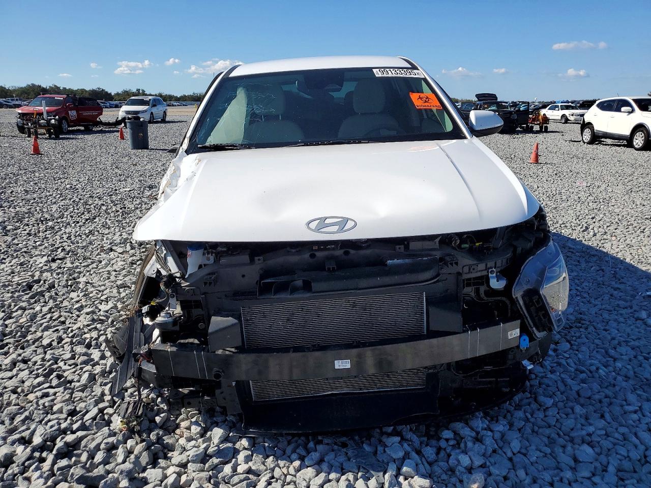 2024 HYUNDAI KONA SE photo 5