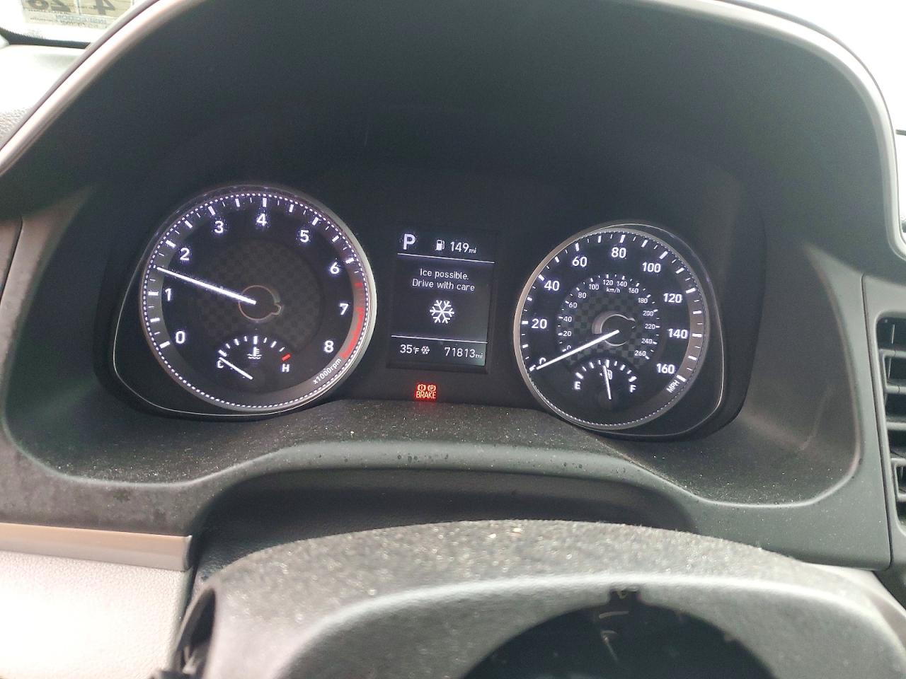 2020 HYUNDAI ELANTRA SEL photo 17