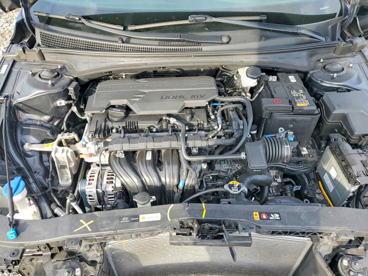 2024 HYUNDAI ELANTRA SEL photo 31