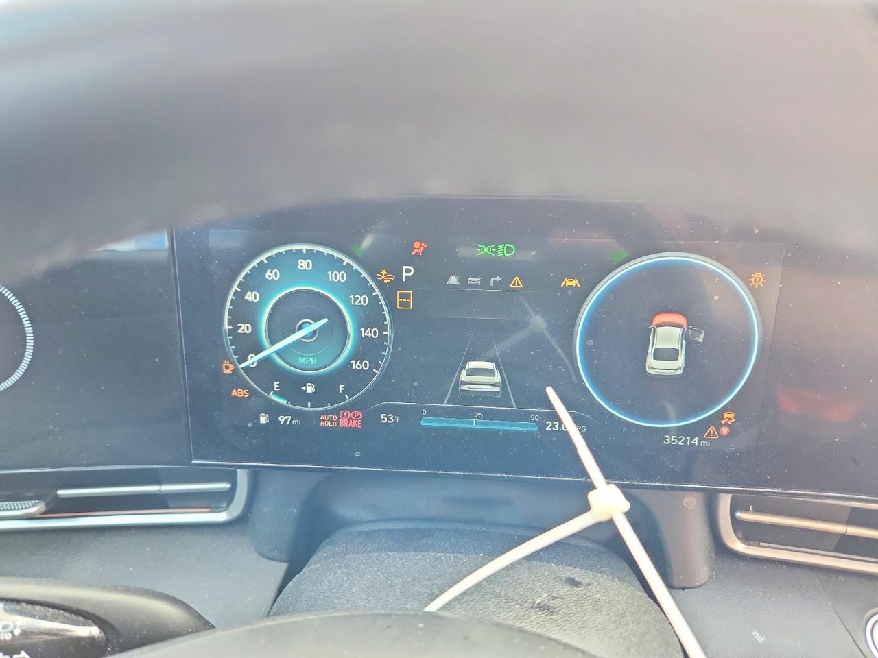 2025 HYUNDAI ELANTRA SEL CONVENIENCE photo 9