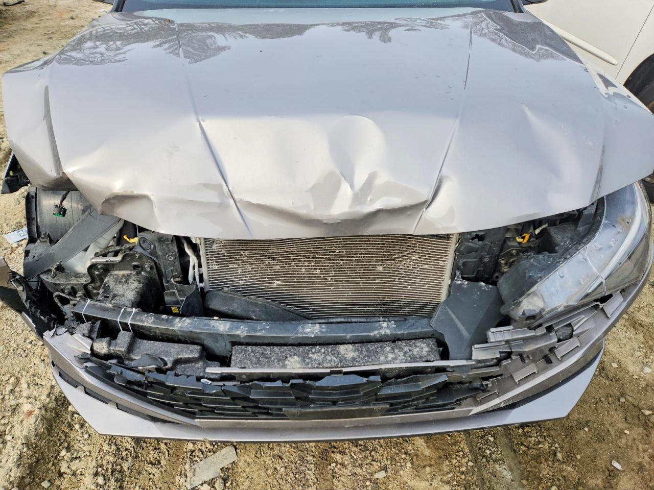2021 HYUNDAI ELANTRA SEL photo 11
