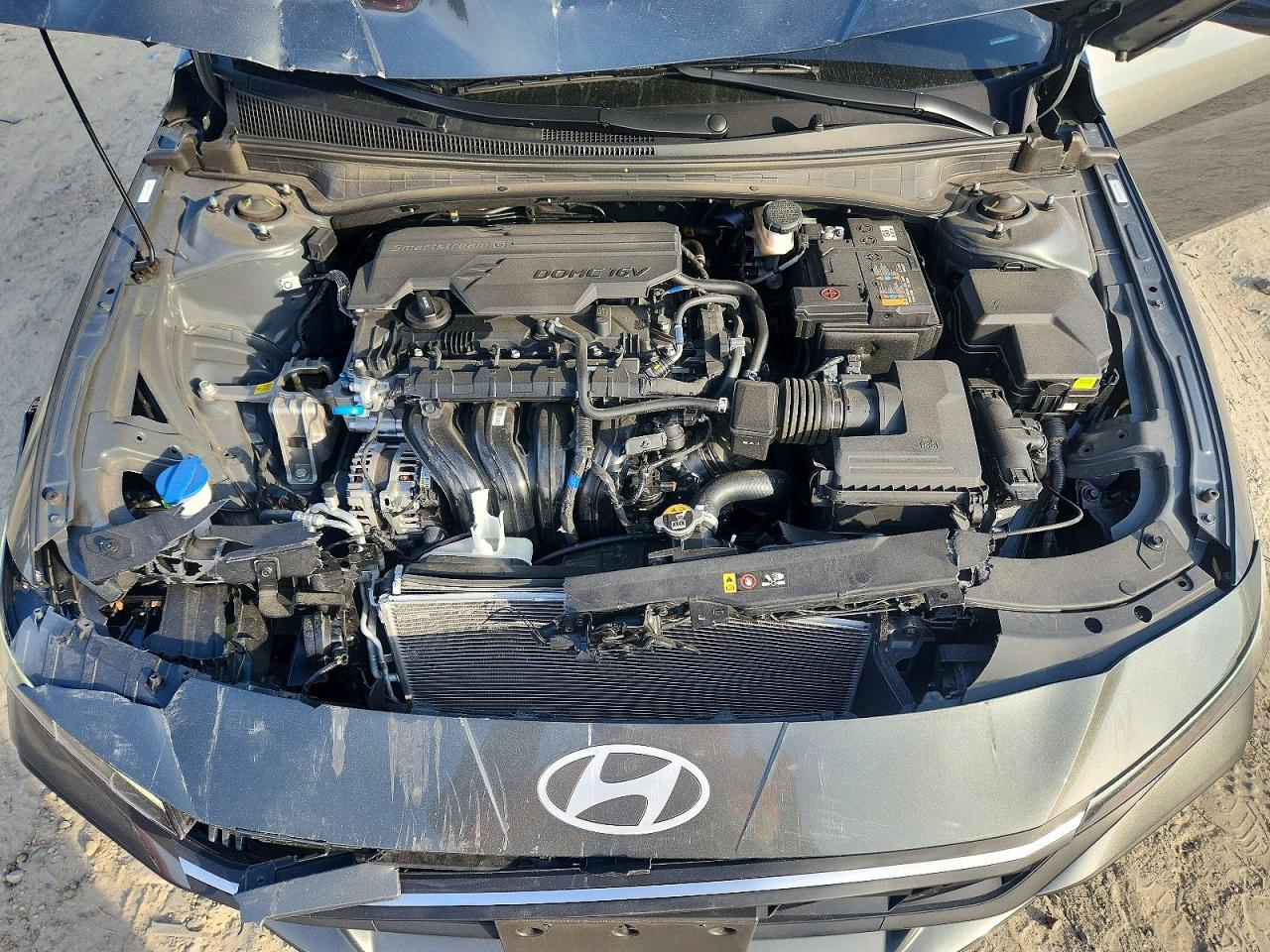 2025 HYUNDAI ELANTRA SEL SPORT photo 11