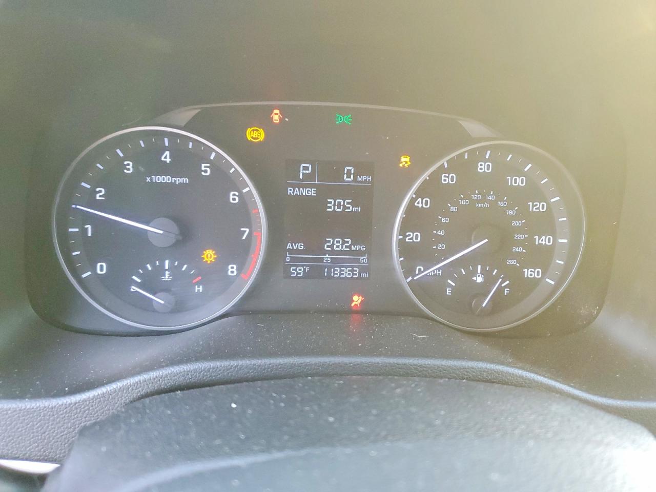 2017 HYUNDAI ELANTRA SE photo 9