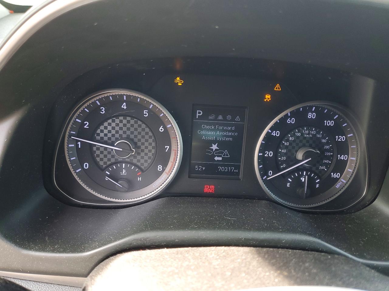 2020 HYUNDAI ELANTRA SEL photo 9