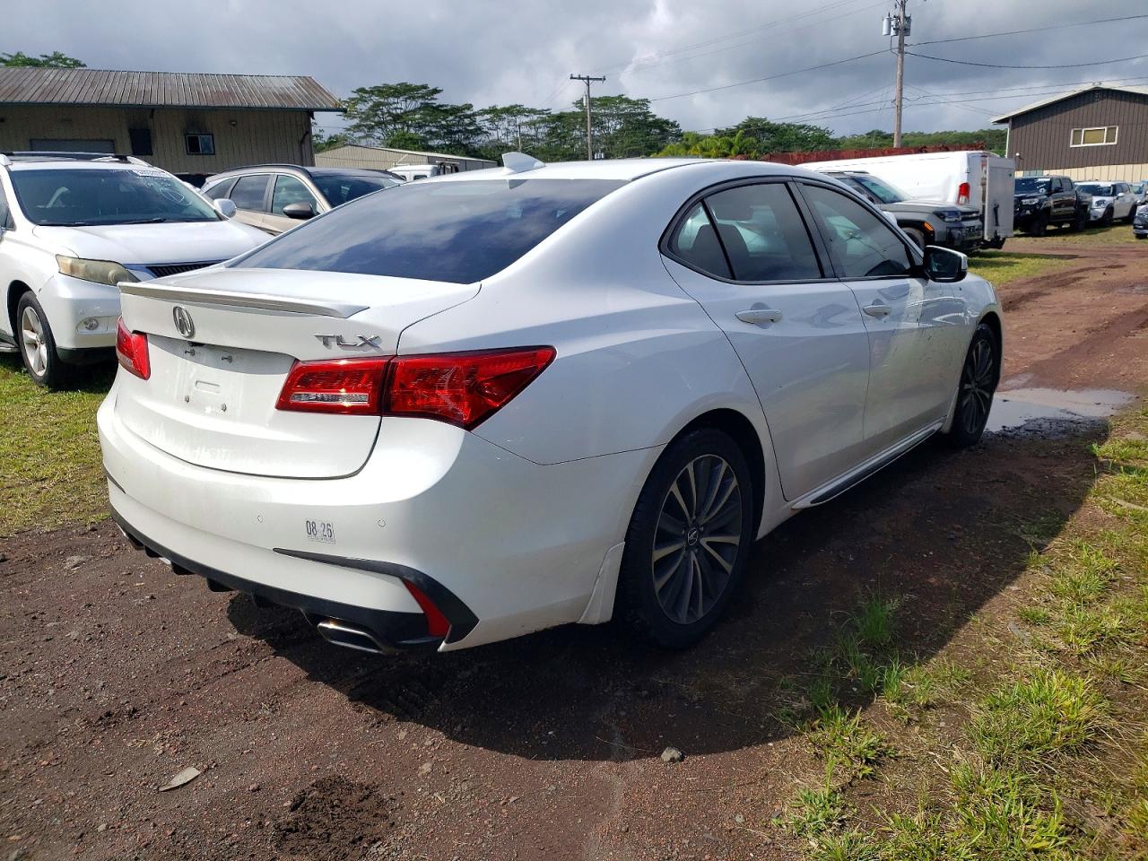 2018 ACURA TLX ADVANCE photo 3