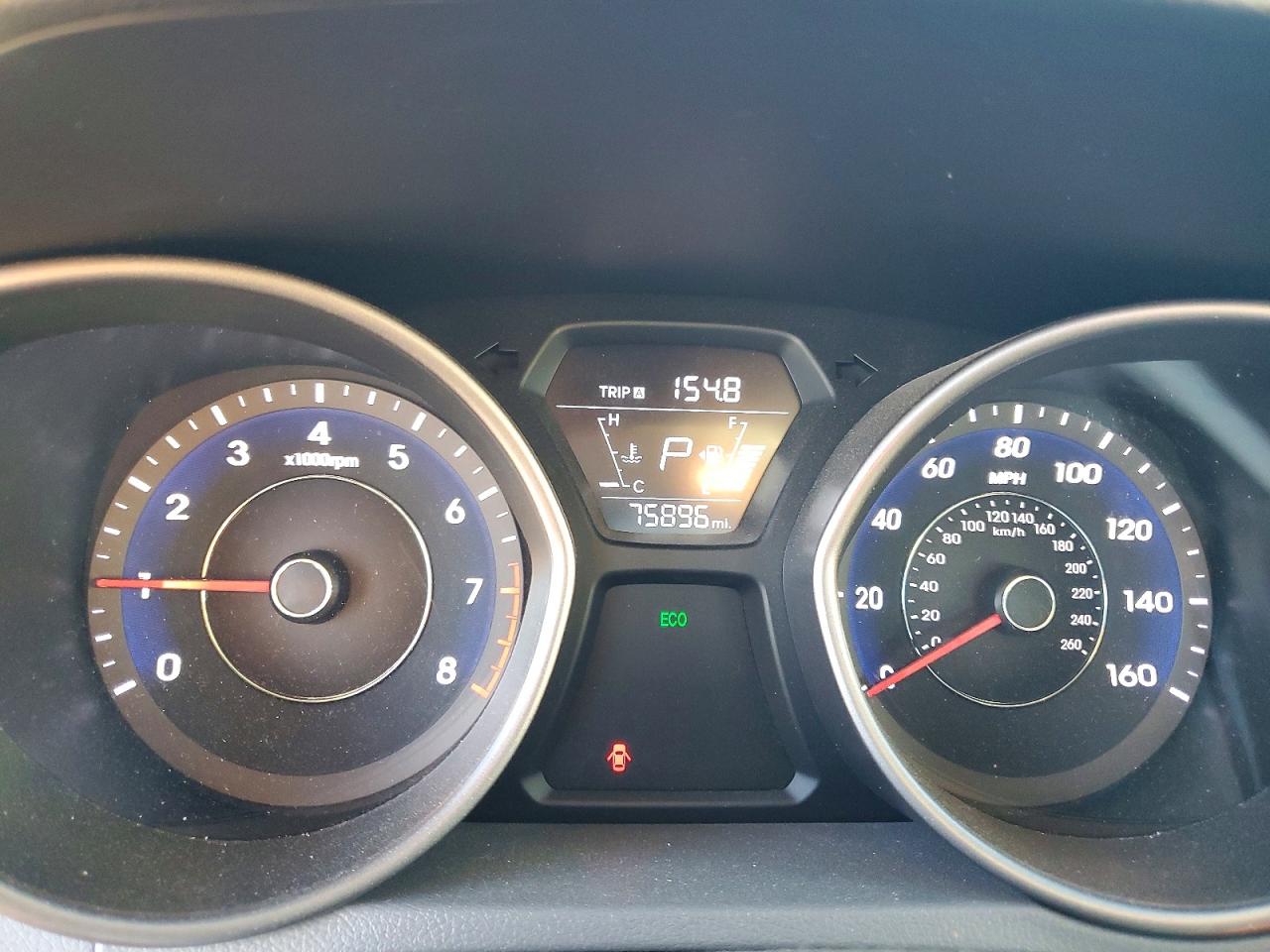 2016 HYUNDAI ELANTRA SE photo 9