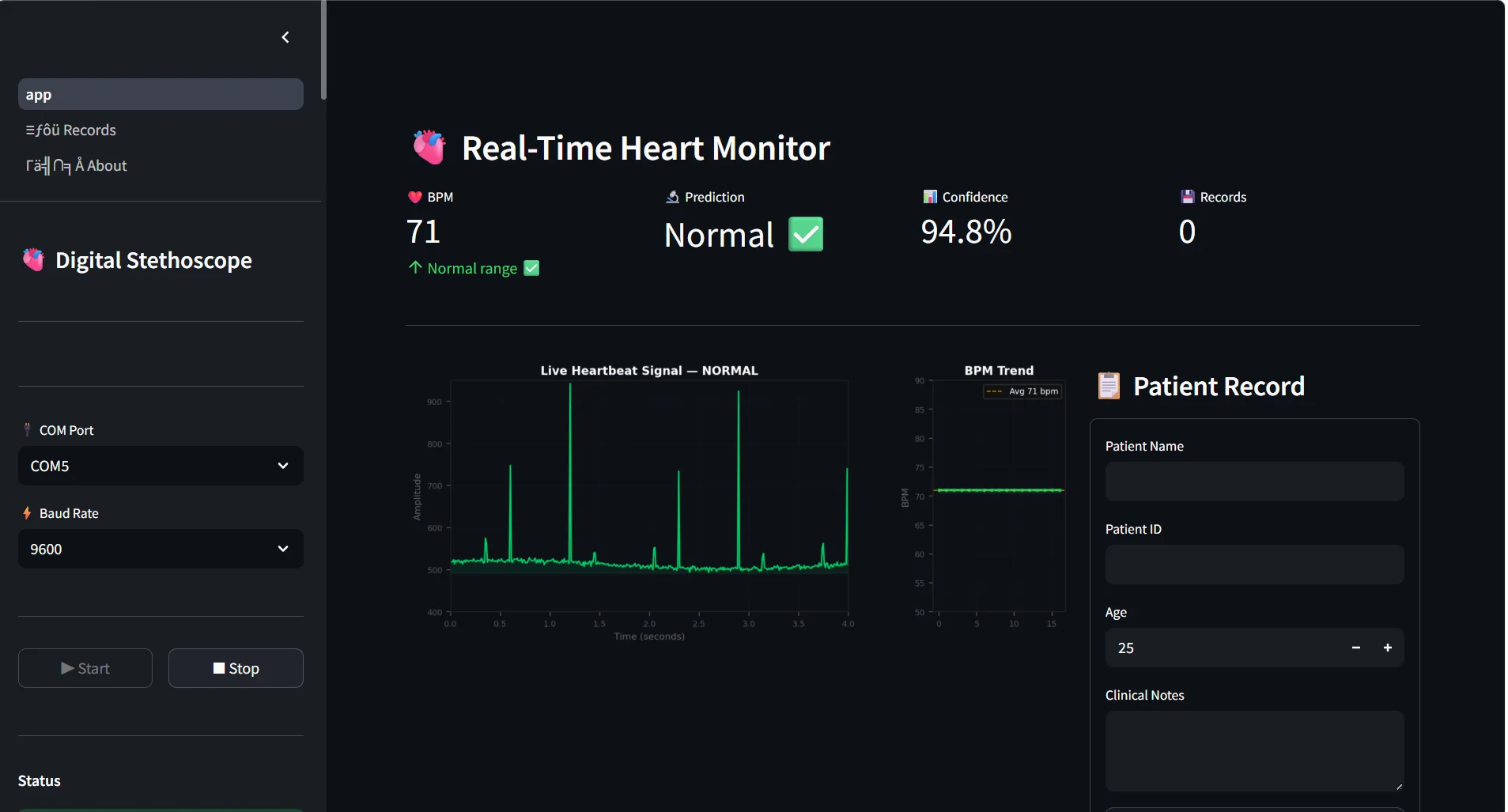 Fig. 4: Streamlit dashboard showing normal heart sound analysis and BPM monitoring.