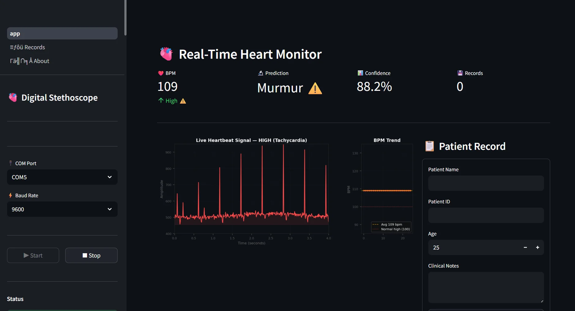 Fig. 5a: Streamlit dashboard showing abnormal heart sound classification with murmur prediction (Panel A).