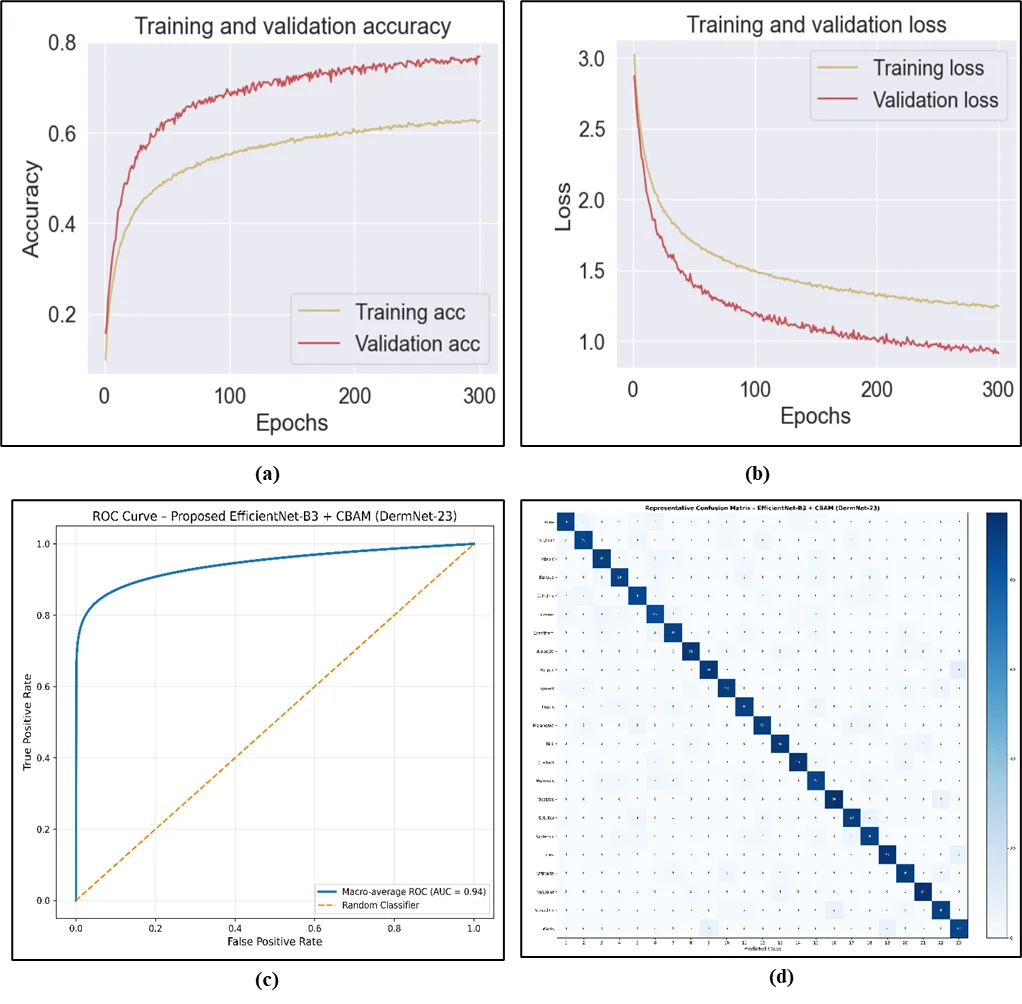 Fig. 4: The result of proposed EfficientNet-B3 + CBAM (a) Accuracy, (b) Loss (c) ROC Curve (d) Confusion Matrix