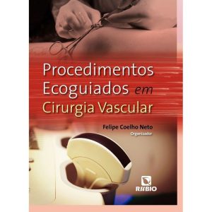 Procedimentos ecoguiados em cirurgia vascular - RUBIO EDITORA LTDA