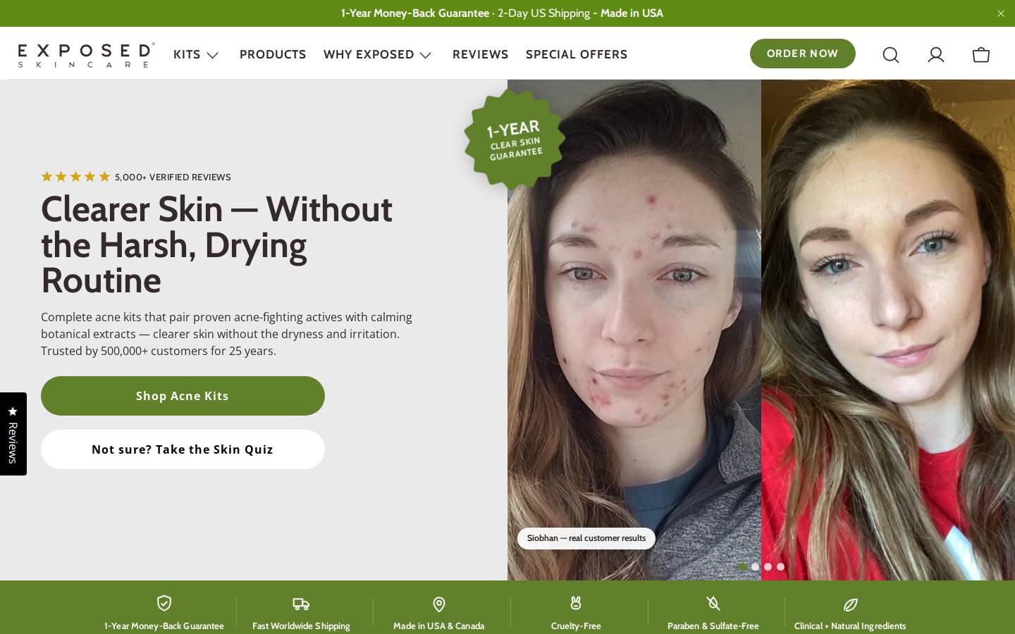 Exposed Skin Care homepage screenshot