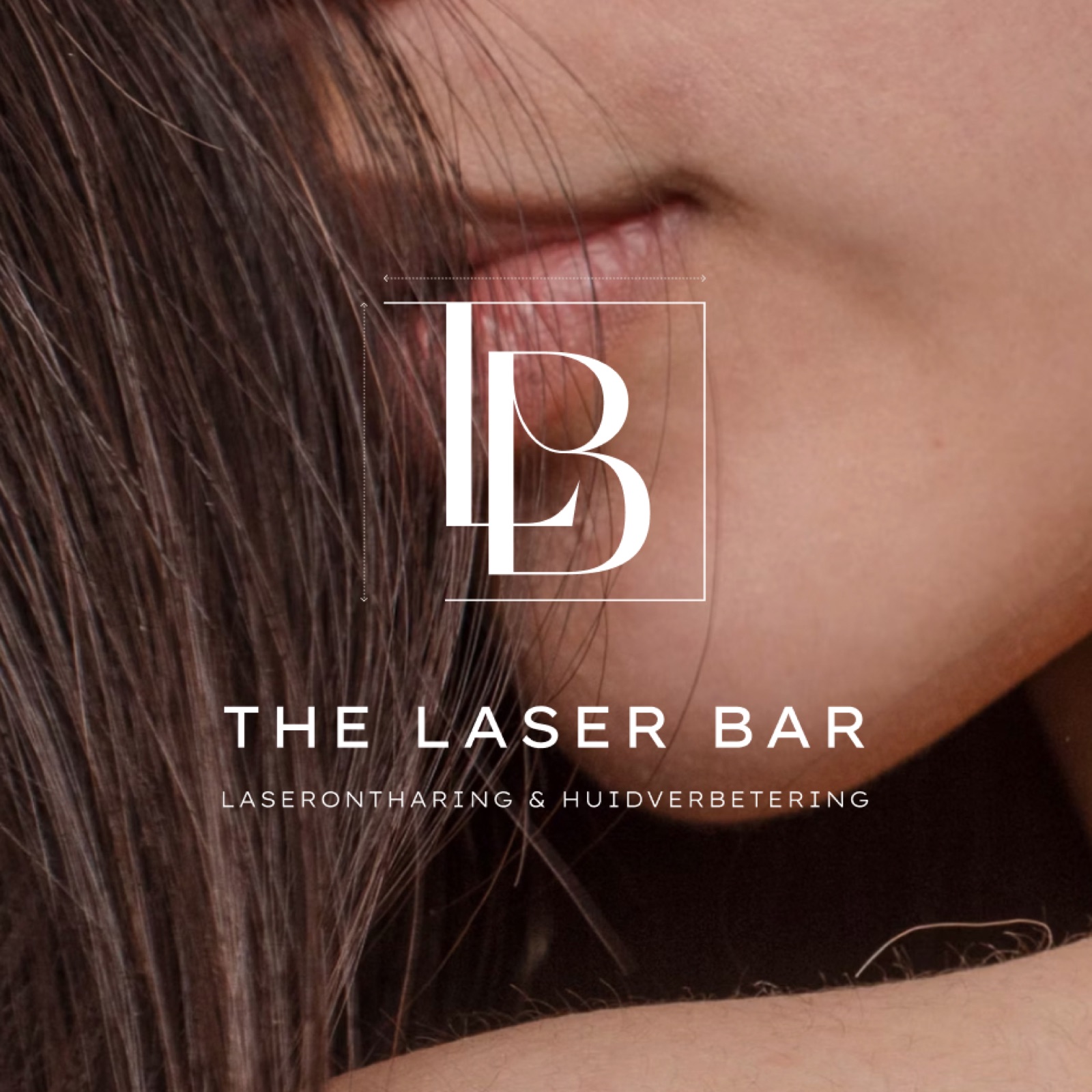 The Laser Bar proces