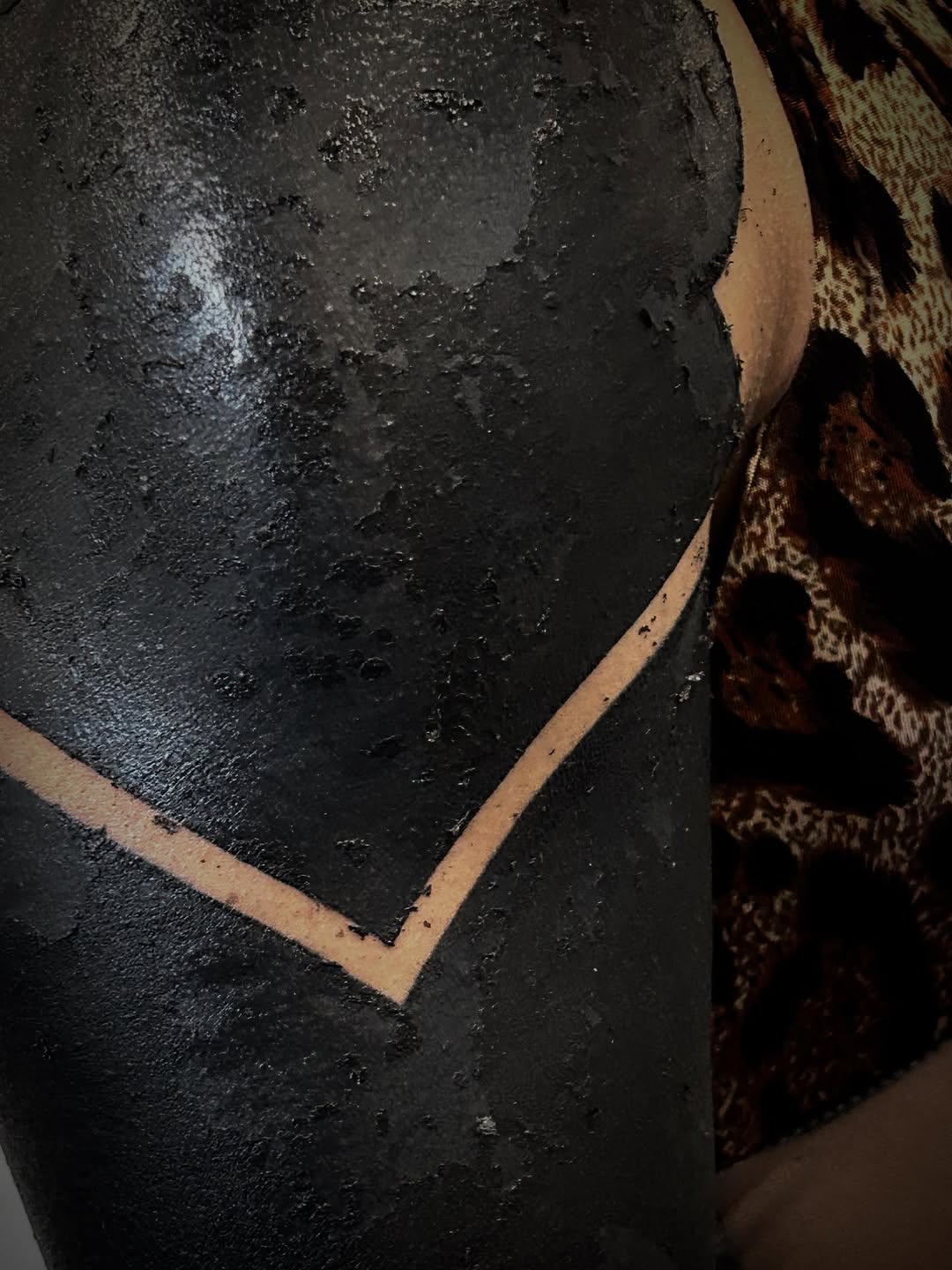 Rugged blackout patch with peeling texture during healing.