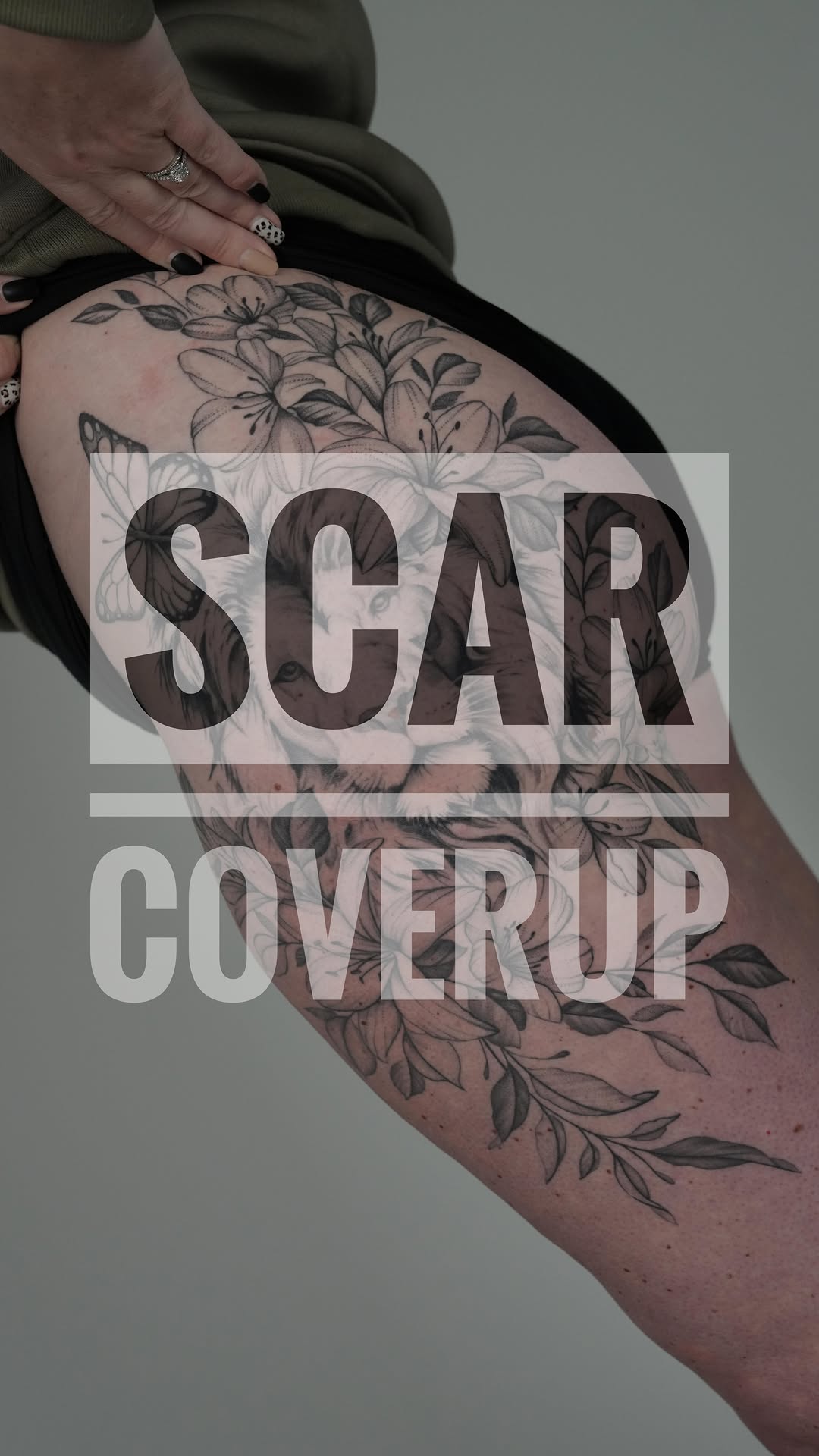 Delicate black-and-gray floral wrap masking leg scar.