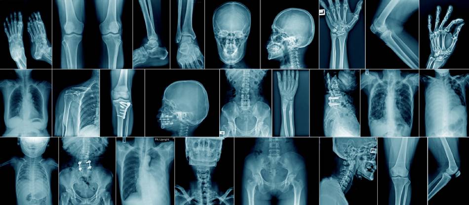 From X-Rays to xtype: How Game-Changing Technologies Illuminate Our World