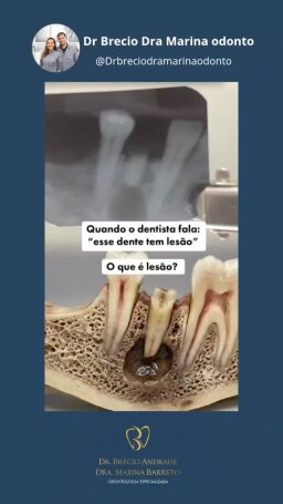 Publicação 2 de @drbreciodramarinaodonto