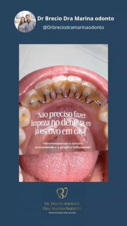 Publicação 5 de @drbreciodramarinaodonto