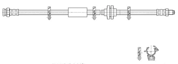 Brake Hose (517072)