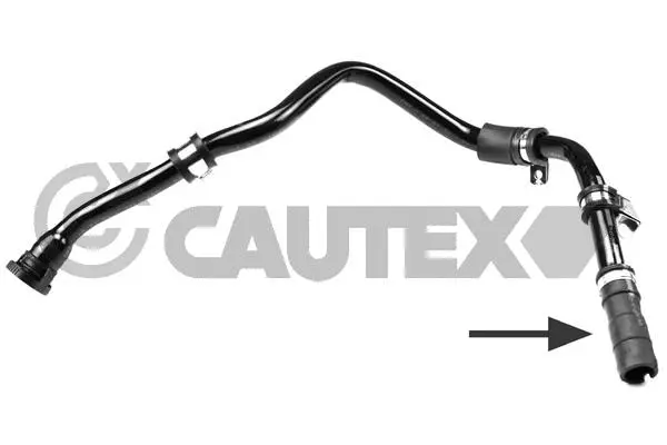 Radiator Hose (753384)