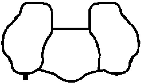 Gasket, intake manifold (WG1765353)