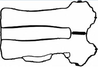 Gasket, cylinder head cover (WG1766978)