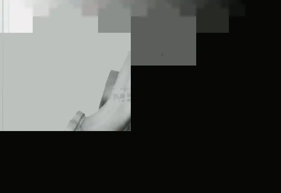 Charger, charging (supercharged/turbocharged) (50418E)