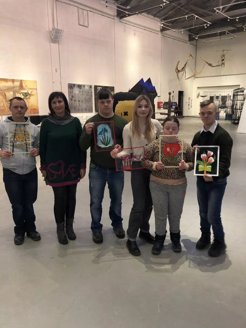 синдром Дауна