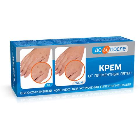 Крем До и После от пигментных пятен